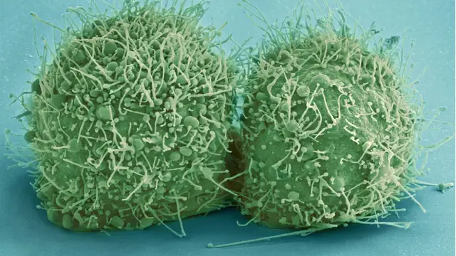 Two HeLa cells shown under a scanning electron microscope tinted green with fine threads covering their surfaces
